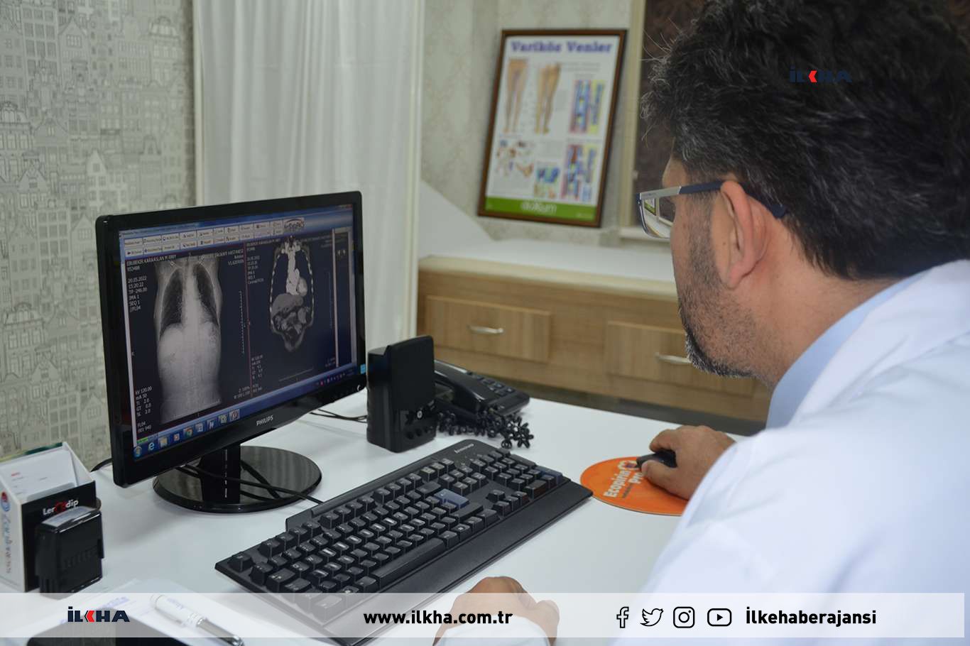 Diyarbakır'da ilk kez mitral kapak yetmezliği ameliyatı yapıldı