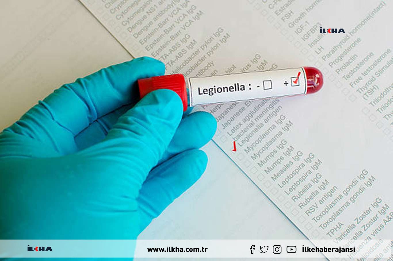 Lejyoner hastalığı nedir belirtileri nelerdir?