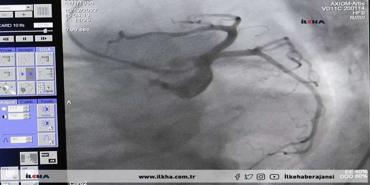 Kalp sağlığının korunması için neler yapılmalı?