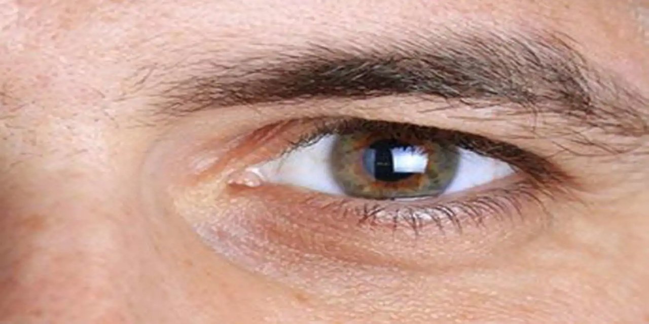Göz tansiyonu neden olur, nelere dikkat edilmeli?