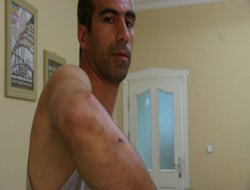 Polis işkencesi iddiası