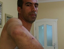 Diyarbakır'daki polis şiddeti TBMM'de