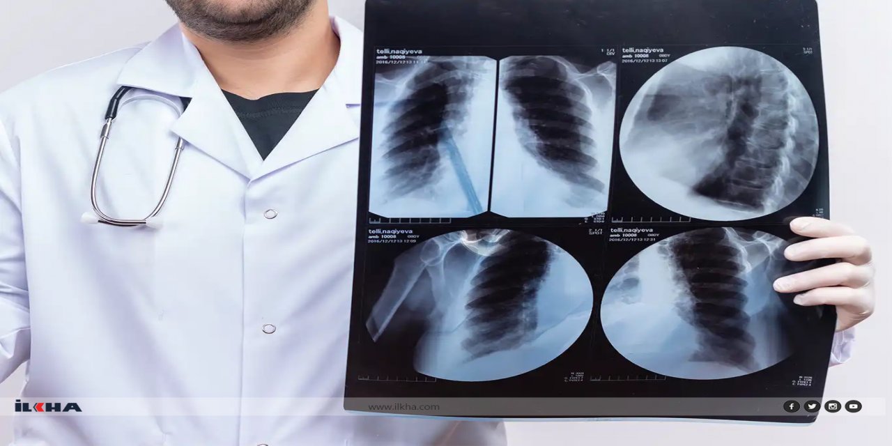 Karaciğer kanserinin tetikleyicileri: Aşırı obezite, alkol ve sigara