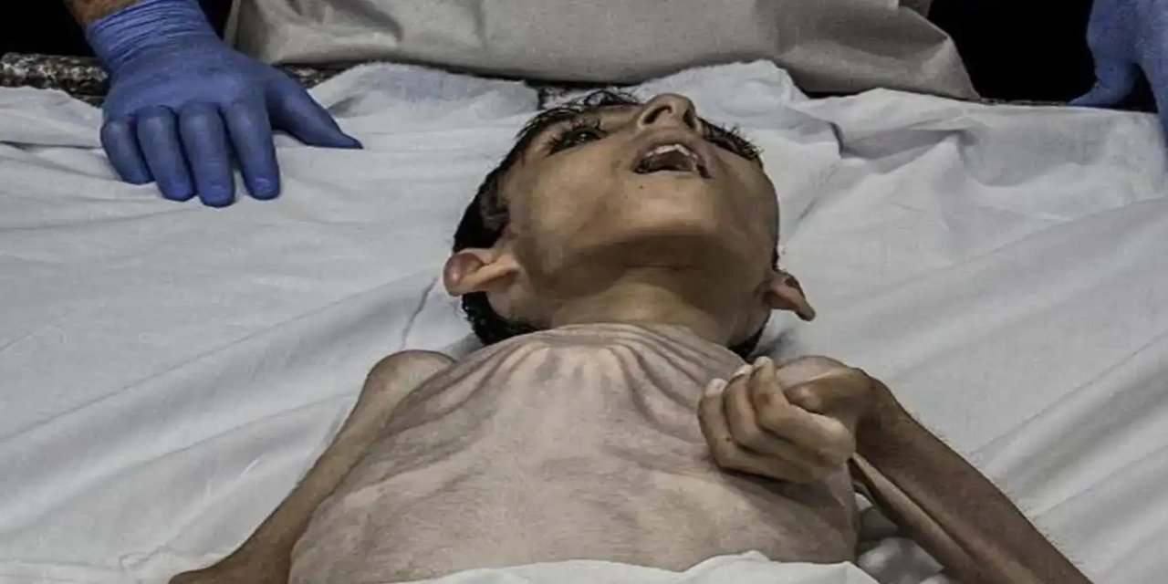 Li Xezzeyê zarokek din ji birçîbûnê wefat kir