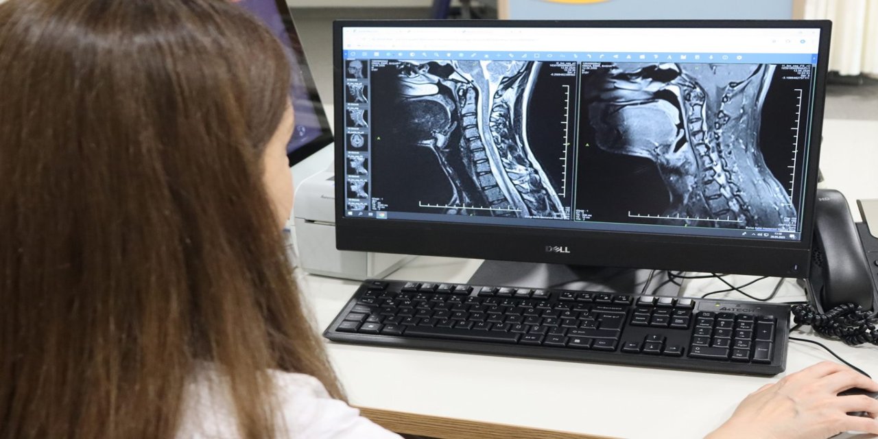 Nöroloji Uzmanı Prof. Dr. Özden Kamışlı: Multiple Skleroz her hastada farklı seyrediyor