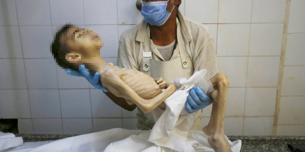 Gazze'de 11 kişi daha açlık nedeniyle öldü