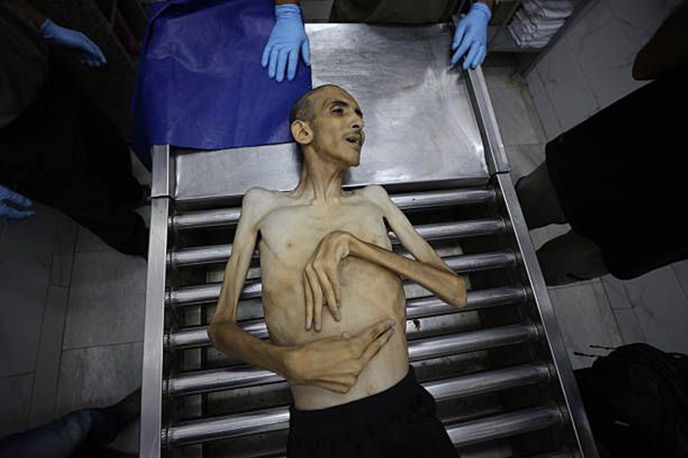 Gazze’de açlıktan ölümler yürek burkuyor