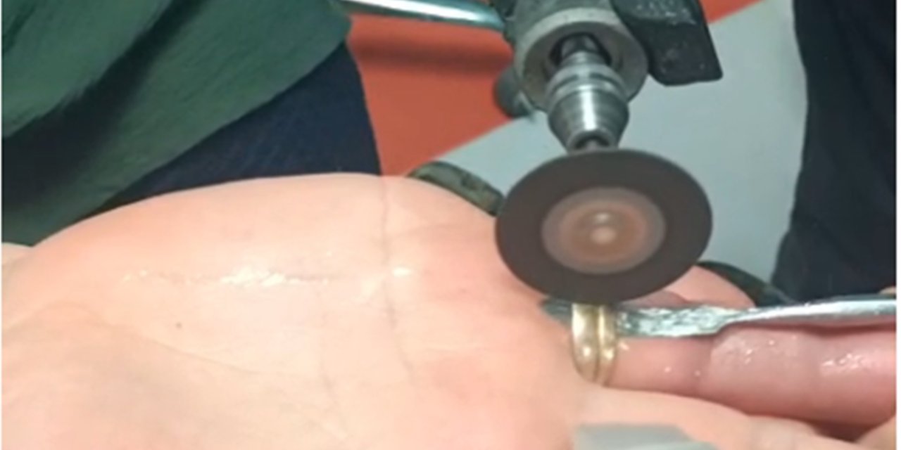 Batman'da parmağa sıkışan yüzüğe itfaiye müdahalesi