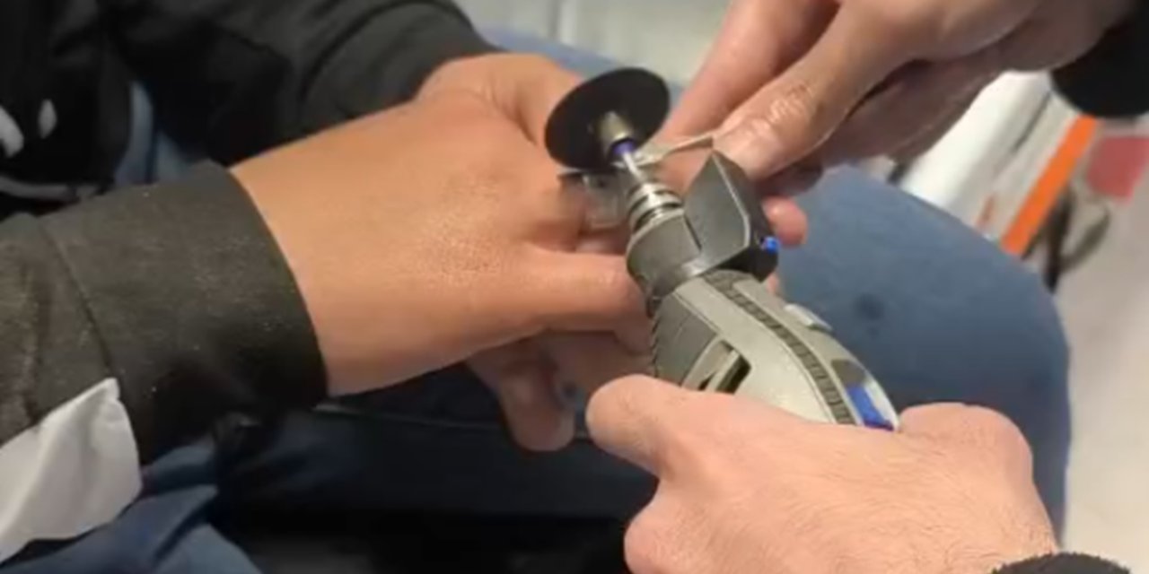 Batman’da parmağa sıkışan yüzüğe itfaiye müdahalesi