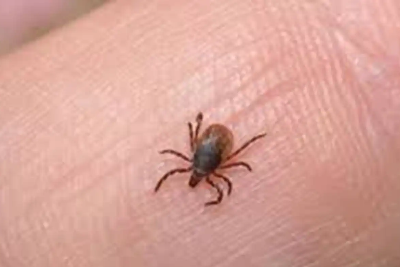 Kene vakalarına karşı nelere dikkat edilmeli