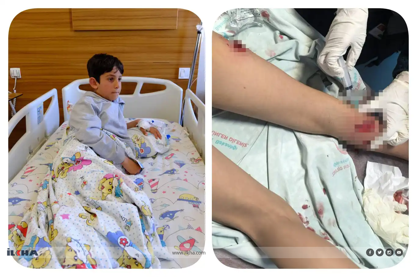Pirsgirêka kûçikên bêxwedî li Wanê canê mirovan êşand: Di 10 rojan de rewşa sêyemîn