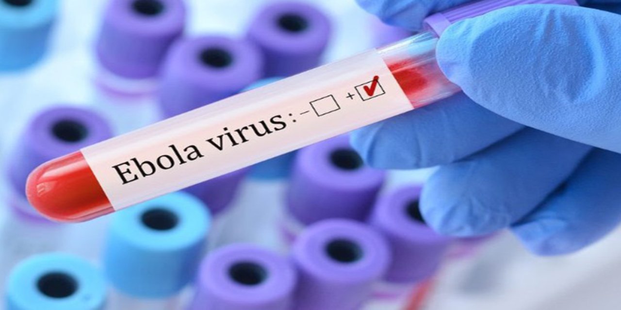 Ebola virüsü nedir?