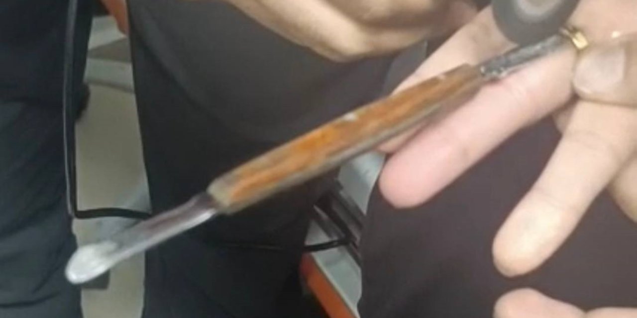 Batman'da parmağa sıkışan yüzük itfaiye ekiplerince kesildi