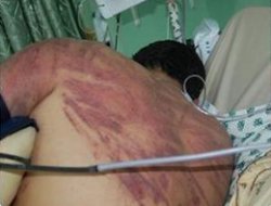 71 Filistinli Esir İşkence Nedeniyle Hayatını Kaybetti