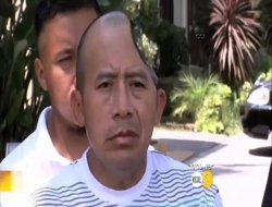 Kafatasının yüzde 25'i yok