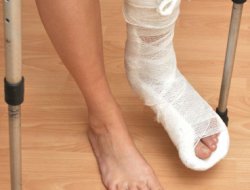 Yazın çocuklarda kırık travmalarına dikkat!