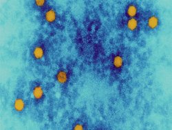 "Corona" Türkiye'de yok