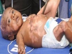 Kendi kendine yanan bebek!