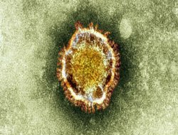 Ölümcül virüs yeniden ortaya çıktı