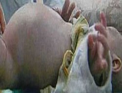 Bebeğin içinden bebek çıktı