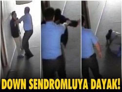 Down sendromluya feci dayak VİDEO