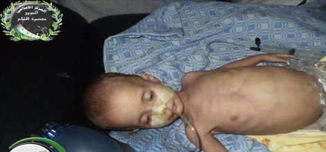 Suriye'de Açlıktan Ölümler Başladı