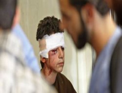 Irak`ta şiddet çocukları da vurdu