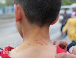 İLKHA'nın Haberi Valiliği Harekete Geçirdi