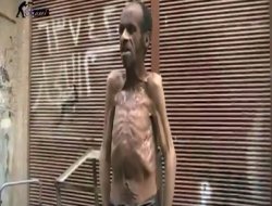 Bu görüntüye yürek dayanmaz!