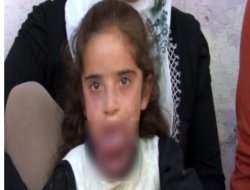 Dili büyüyen 7 yaşındaki Rozelin yardım bekliyor