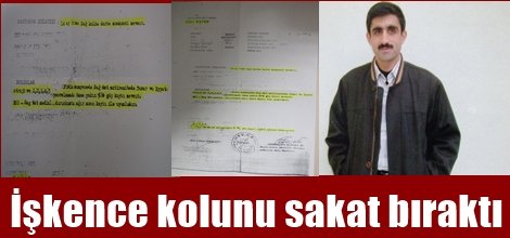 İşkence kolunu sakat bıraktı