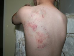 Saldırgan eşek küçük çocuğu yaraladı