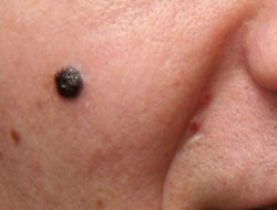 Hangi benler alarm veriyor?