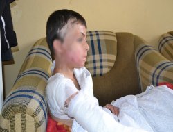 Suriyeli Meryem ameliyat edildi