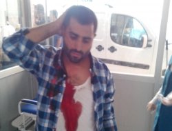 HDP/PKK'liler Diyarbakır Köy-Der'i  taradı: 12 yaralı