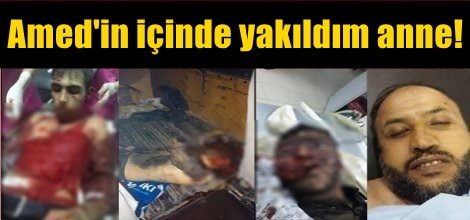 Amed'in içinde yakıldım anne!