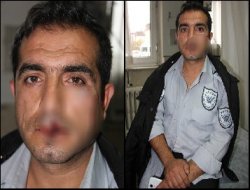 Uzman çavuş, hastane güvenlikçisini darp etti iddiası