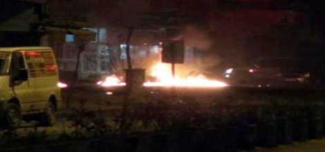 Cizre'deki çocuk 6-8 Ekim olaylarında çalınan fişekle vurulmuş