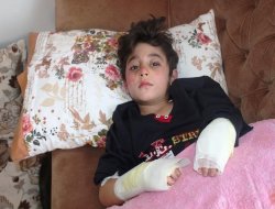 Batman’daki yangında 2 kardeş ölümden döndü