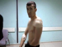 Polis durmayan araca ateş açıtı: 1 yaralı