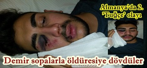 Demir sopalarla öldüresiye dövdüler