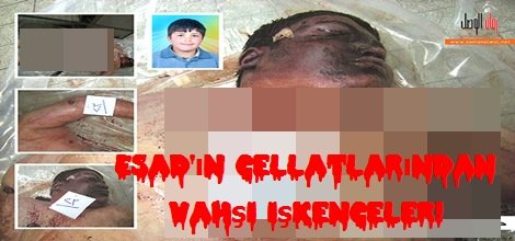 Esad'ın cellatlarından vahşi işkenceler!