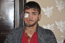 Tek isteği estetik olup işe girebilmek