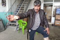 İşe giderken sokak köpeklerinin saldırısına uğradı