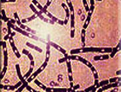 ABD'de 9 eyalete ve Güney Kore'deki üssünde, şarbon paniği yaşıyor