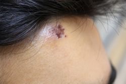 Diyarbakır’da, “Mısır protestosunda polis bilerek bize saldırdı” foto video