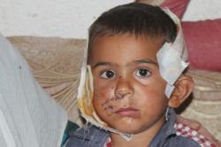 Köpeğin ısırıp kaçırdığı çocuk ölümden döndü