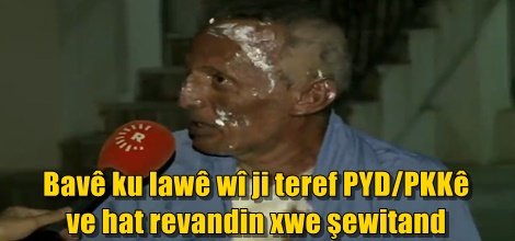 Bavê ku lawê wî ji teref PYD/PKKê ve hat revandin xwe şewitand