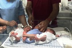 Yaşamaz denilen üçüzler hayata bağlandı