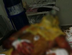 Kazada yanarak ağır yaralanan 2 kişi hayatını kaybetti